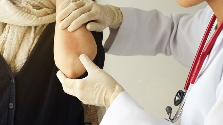 Doctor examines the elbow for psoriasis