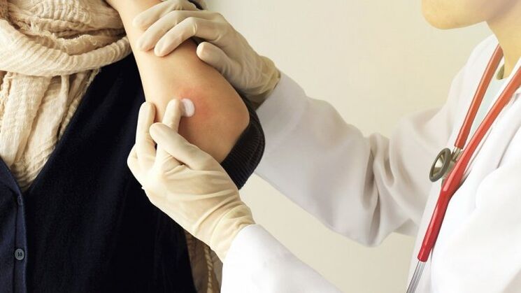 the doctor lubricates the elbow for psoriasis